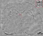 Quantitative phase macroscopic system for label-free imaging of tissue sections