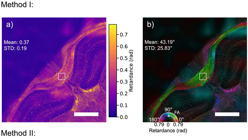 Dual-shot polarization digital holographic microscopy with phase bias equalization for full-field Jones matrix imaging