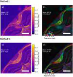 Dual-shot polarization digital holographic microscopy with phase bias equalization for full-field Jones matrix imaging