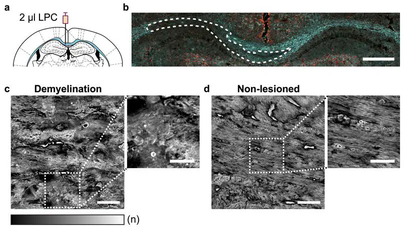 Label-free holotomographic imaging of brain myelin
